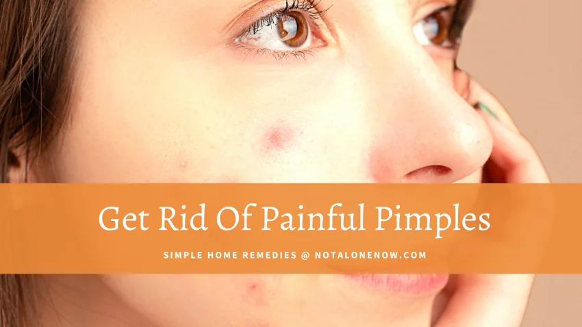 Instant Relief From Painful Pimples